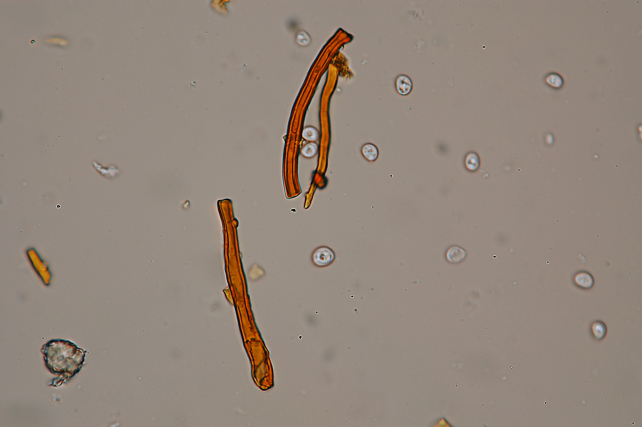 Un lignicolo del Ceppo (Phellinus pomaceus)